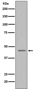 Caspase-9 CASP9 Rabbit Monoclonal Antibody