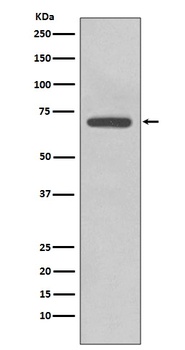 COX2 PTGS2 Rabbit Monoclonal Antibody