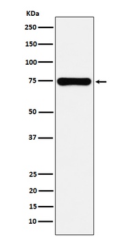 Cox2 PTGS2 Rabbit Monoclonal Antibody
