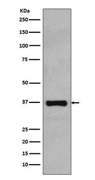 Rad51 Rabbit Monoclonal Antibody