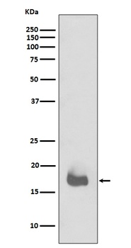 IL1 beta Rabbit Monoclonal Antibody
