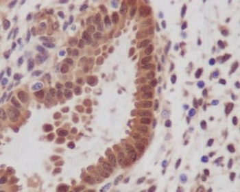 YAP1/Yap Rabbit Monoclonal Antibody