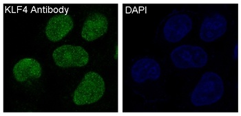 KLF4/Gklf Rabbit Monoclonal Antibody