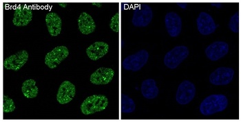 Brd4 Rabbit Monoclonal Antibody