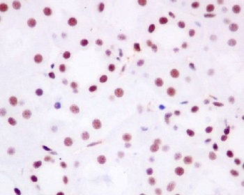 Brd4 Rabbit Monoclonal Antibody