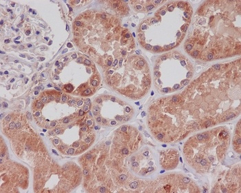 TLR2 Rabbit Monoclonal Antibody