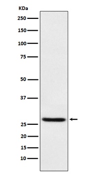 EIF4E Rabbit Monoclonal Antibody
