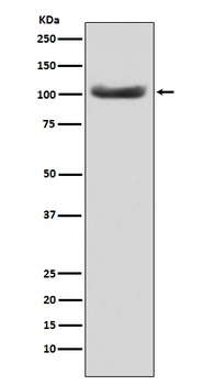 MSH2 Rabbit Monoclonal Antibody