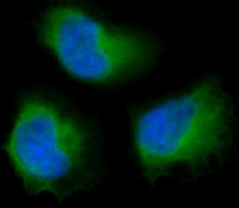 FAK PTK2 Rabbit Monoclonal Antibody