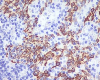 CCR2/CKR2 Rabbit Monoclonal Antibody