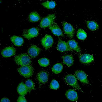 SLC2A1 Mouse Monoclonal Antibody