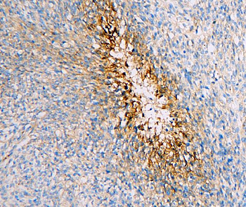 SLC2A1 Mouse Monoclonal Antibody