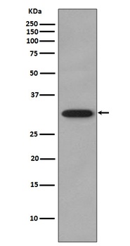 CDK2 Rabbit Monoclonal Antibody