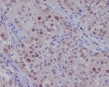 CDK2 Rabbit Monoclonal Antibody