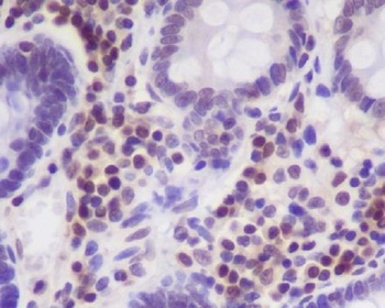 p27 KIP 1 CDKN1B Rabbit Monoclonal Antibody
