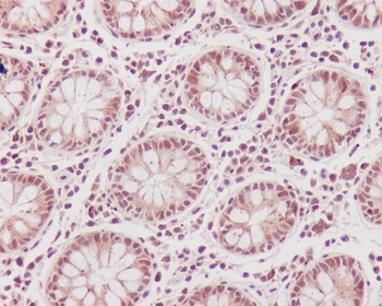 CDK1/Cdc2 Rabbit Monoclonal Antibody