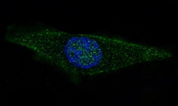 GFAP Rabbit Monoclonal Antibody