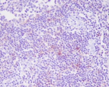 CD25 IL2RA Rabbit Monoclonal Antibody