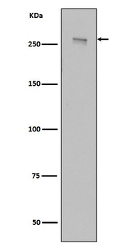 LRRK2 Rabbit Monoclonal Antibody
