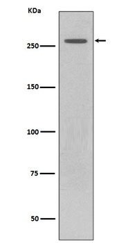 LRRK2 Rabbit Monoclonal Antibody