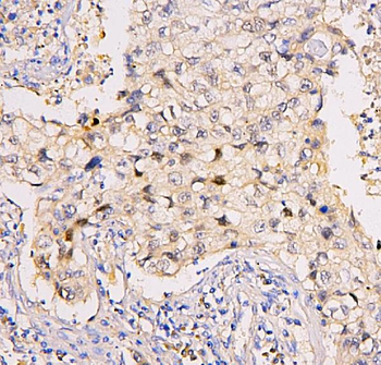 BRG1 SMARCA4 Mouse Monoclonal Antibody