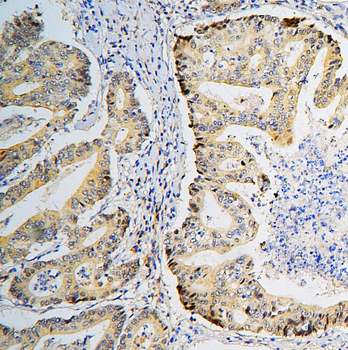 BRG1 SMARCA4 Mouse Monoclonal Antibody