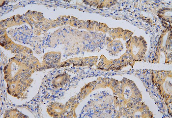 BRG1 SMARCA4 Mouse Monoclonal Antibody