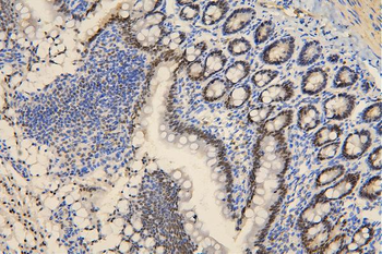 BRG1 SMARCA4 Mouse Monoclonal Antibody