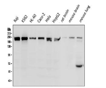 BRG1 SMARCA4 Mouse Monoclonal Antibody
