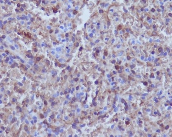 Hemoglobin subunit alpha HBA1 Rabbit Monoclonal Antibody