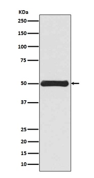 Vimentin Rabbit Monoclonal Antibody