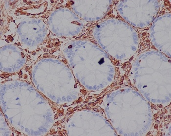 Vimentin Rabbit Monoclonal Antibody