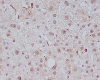Heme Oxygenase 1 HMOX1 Rabbit Monoclonal Antibody