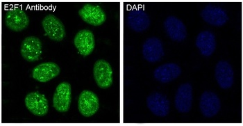 E2F1 Rabbit Monoclonal Antibody