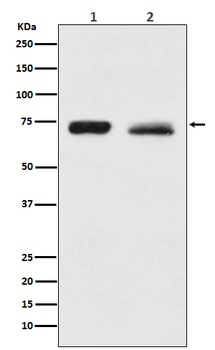 NF2/Merlin Rabbit Monoclonal Antibody