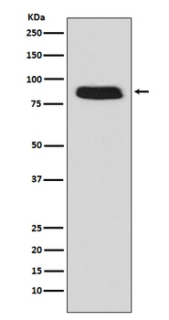 GCSF Receptor Rabbit Monoclonal Antibody