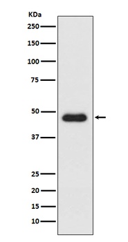 CXCR3 Rabbit Monoclonal Antibody
