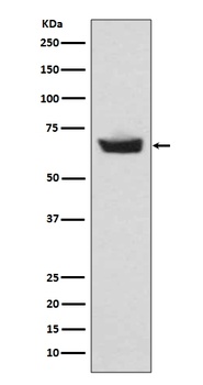 CETP Rabbit Monoclonal Antibody