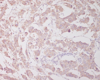 Beclin 1 BECN1 Rabbit Monoclonal Antibody