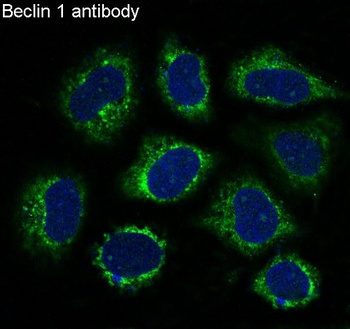 Beclin 1 BECN1 Rabbit Monoclonal Antibody