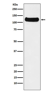 DDB1 Rabbit Monoclonal Antibody