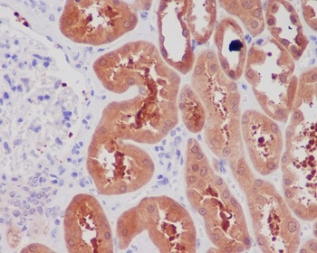 NGF/Beta Ngf Rabbit Monoclonal Antibody