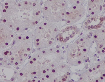 HNF-4-alpha/HNF Rabbit Monoclonal Antibody