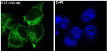 GST GSTP1 Rabbit Monoclonal Antibody
