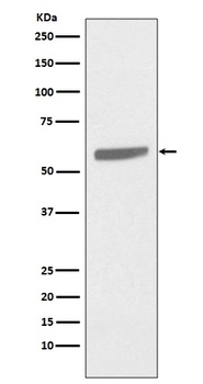 Cytokeratin 5 KRT5 Rabbit Monoclonal Antibody