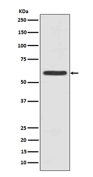 Cytokeratin 5 KRT5 Rabbit Monoclonal Antibody