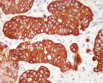 Cytokeratin 5 KRT5 Rabbit Monoclonal Antibody