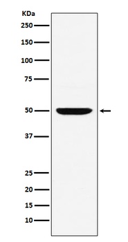 MUM1 Rabbit Monoclonal Antibody