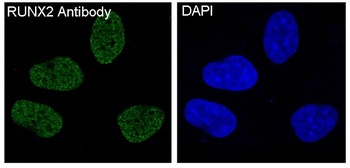 RUNX2 Rabbit Monoclonal Antibody