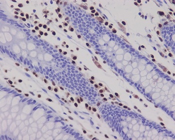RUNX2 Rabbit Monoclonal Antibody